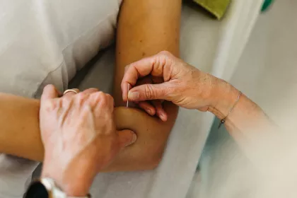 dry needling beter bewegen brugge